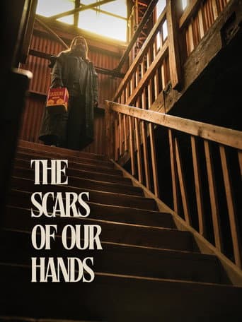 The Scars of Our Hands
